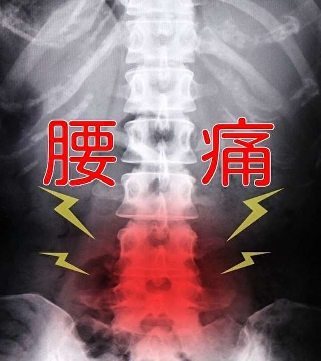 腰痛