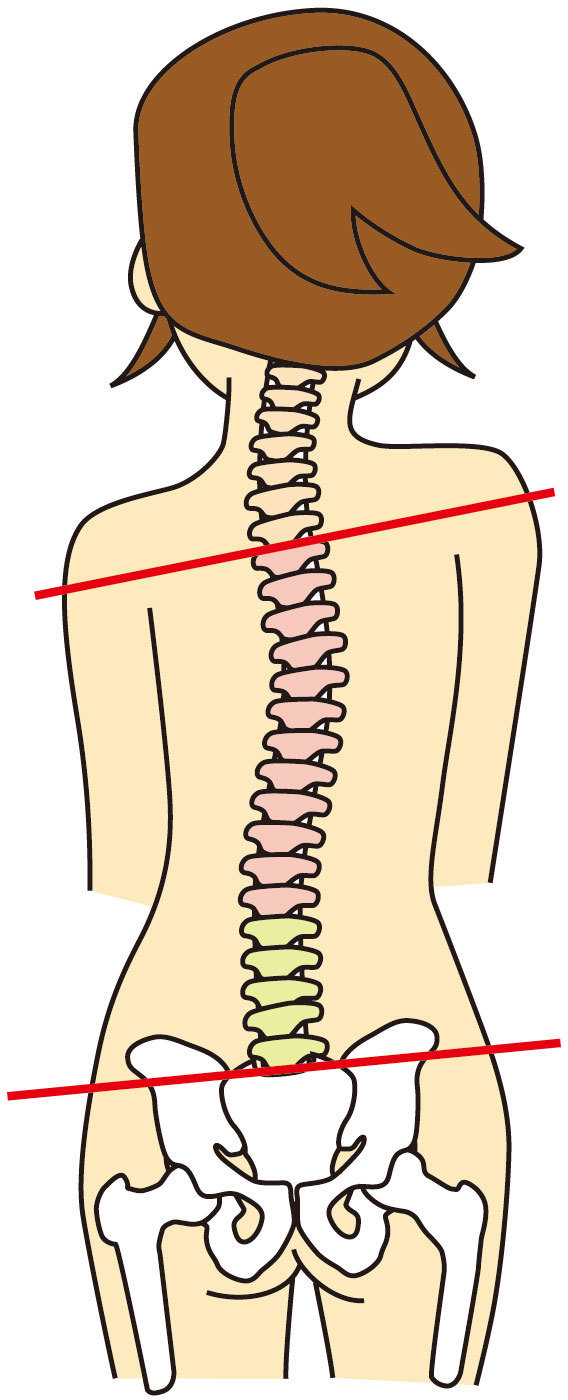 骨盤の歪み