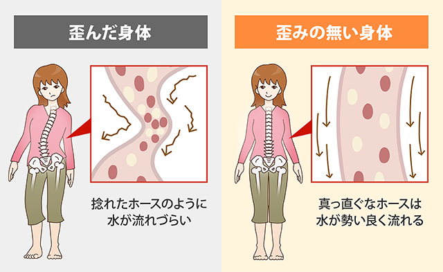 歪んだ身体と歪みのない身体