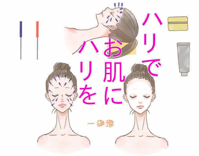 美容鍼灸、美顔鍼灸